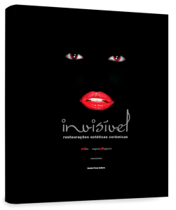 invisivel-restauracoes-esteticas-ceramicas-201301081142151