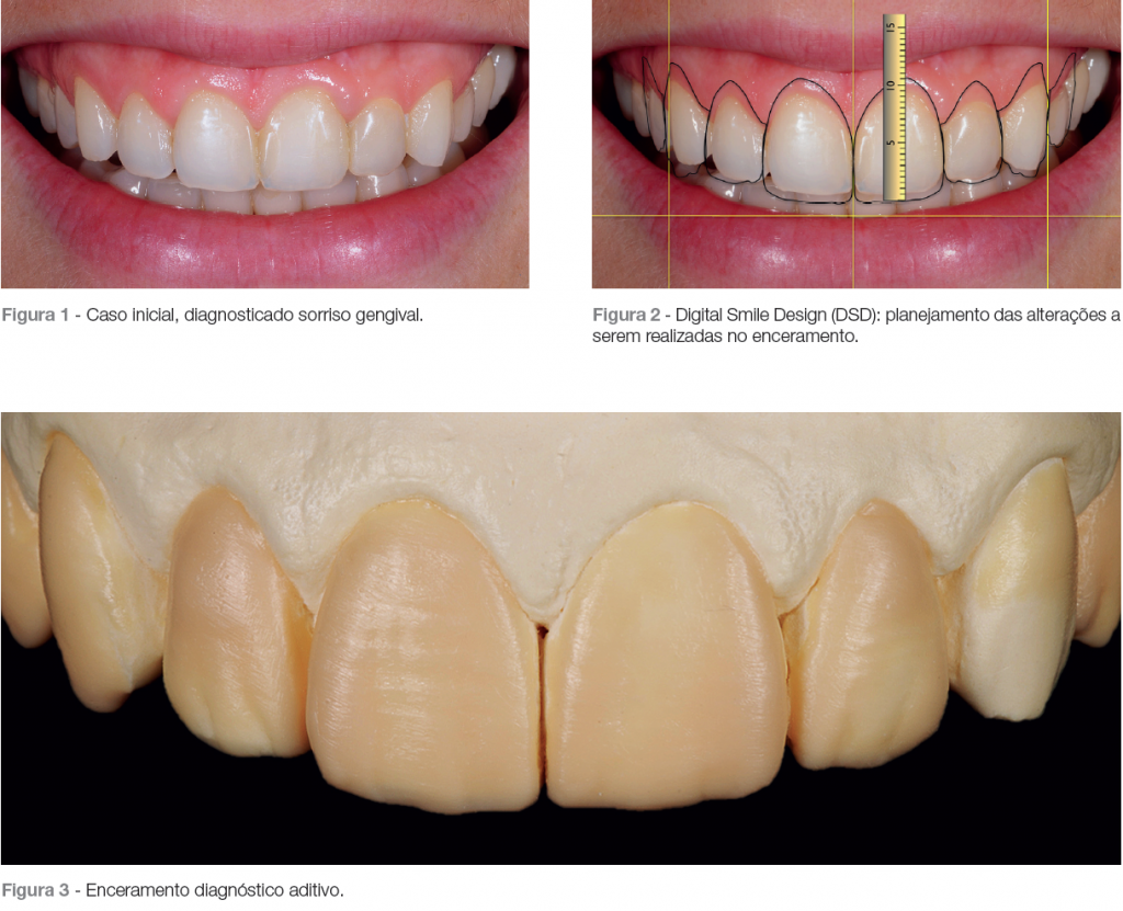 Captura de Tela 2016-05-04 às 11.39.30