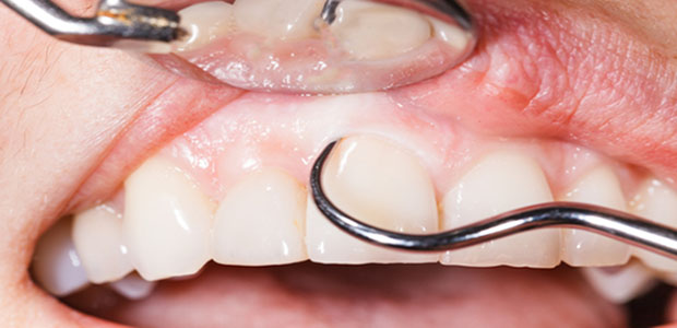 Periodic dental examination to have a healthy mouth and teeth.