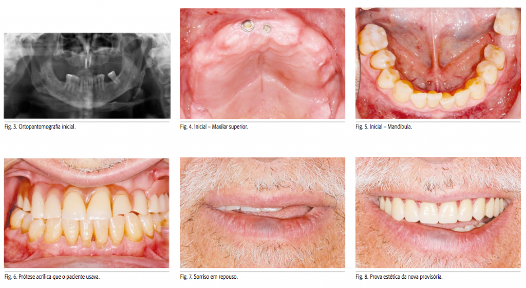 Captura de Tela 2016-07-13 às 17.25.13
