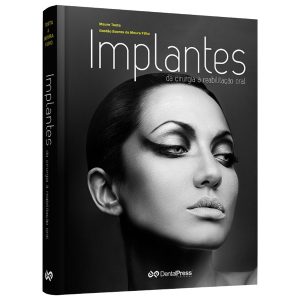 implantes
