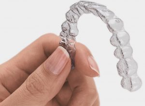 ca clear aligner