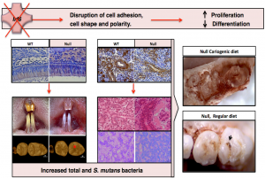 Mecanismo proposto para explicar a influência da ablação com IRf6 na atividade de cárie. (Fonte: Divulgação)