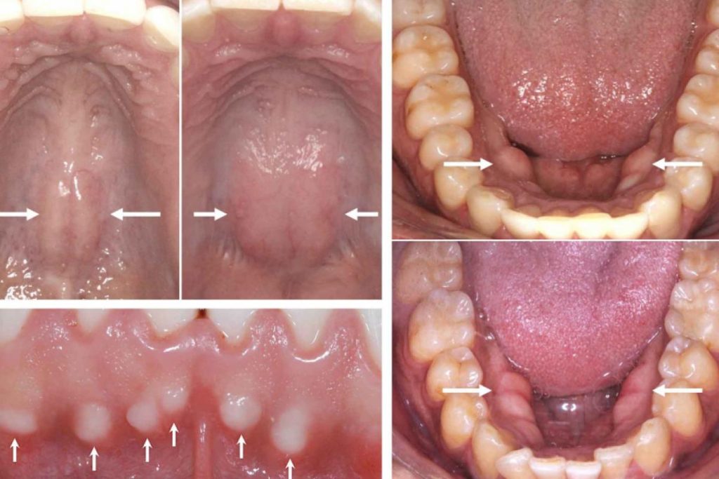 Alberto Consolaro “Como explicar os Toros?”
