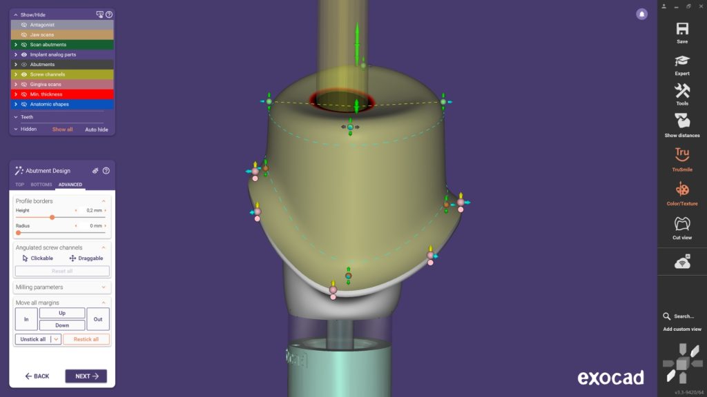 Lançamento do exocad DentalCAD 3.3 Chemnitz