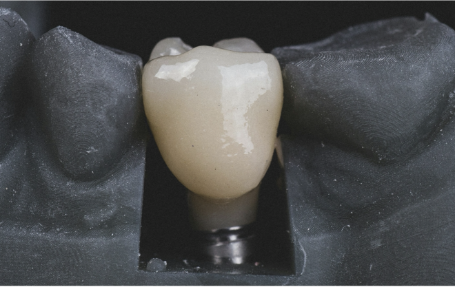 Estudo diz a falha de antibióticos em infecções em implantes