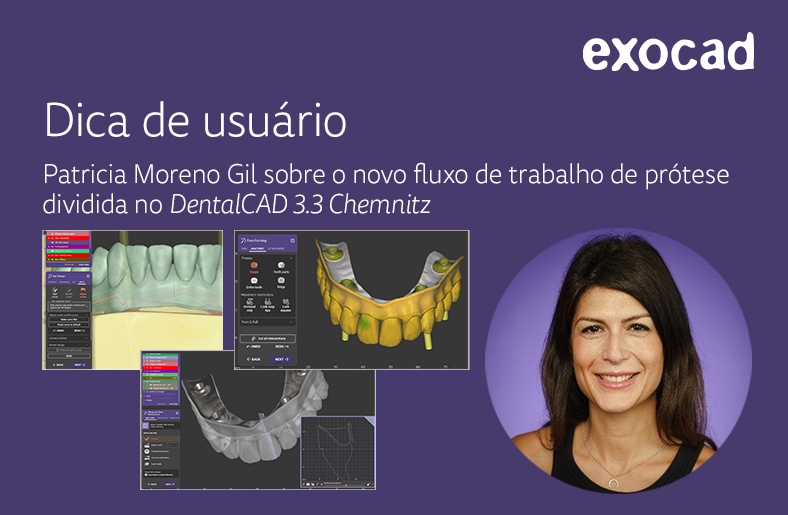 Exocad DentalCAD 3.3 Chemnitz: Fluxo de trabalho de prótese dividida