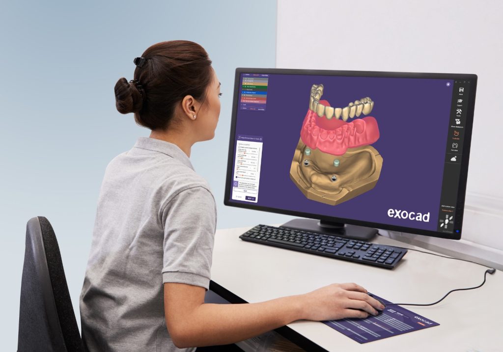 A EXOCAD INTRODUZ UM MODELO DE ASSINATURA MENSAL FLEXÍVEL PARA SEU SOFTWARE